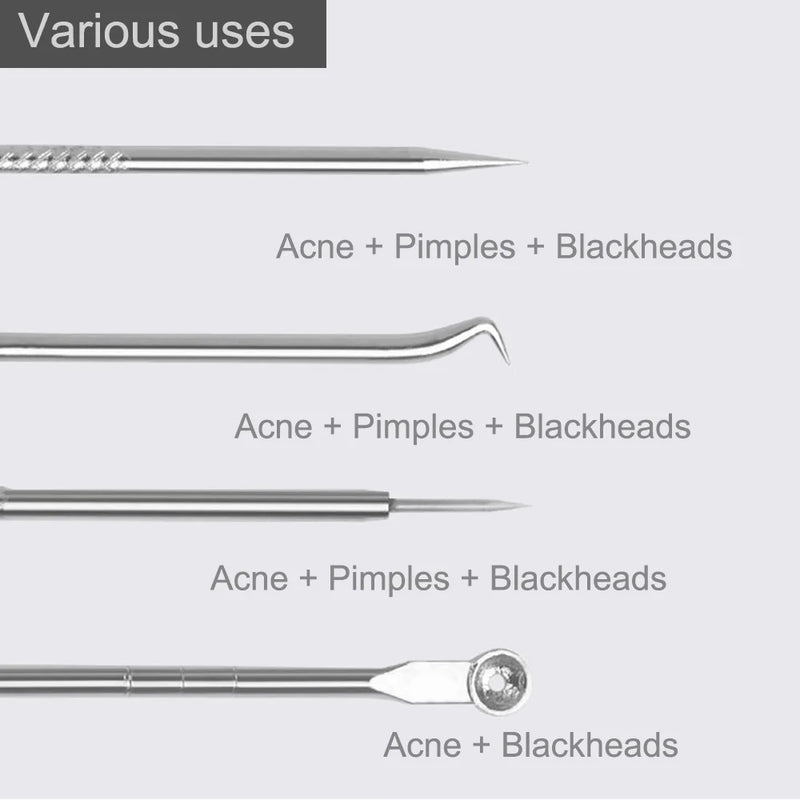 Removedor de cravos e acne - 4 Peças